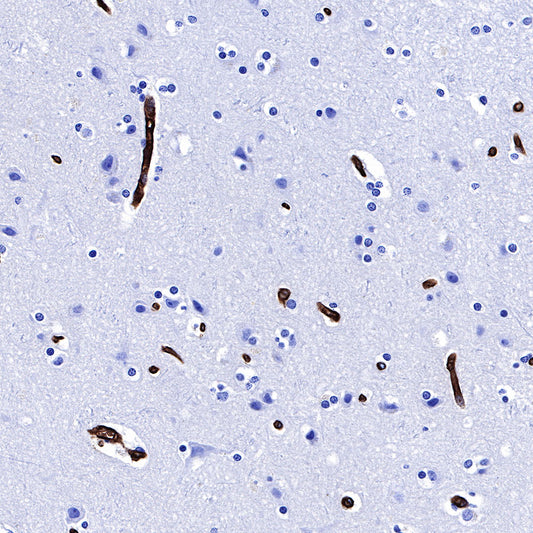 S-RMab® GLUT1 Recombinant Rabbit mAb (SDT-047-53)