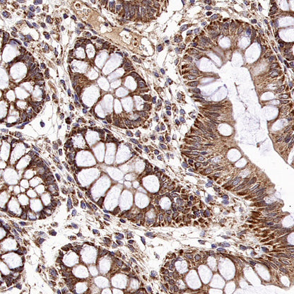 Mitofusin 2 Recombinant Rabbit mAb (S-1783-49)
