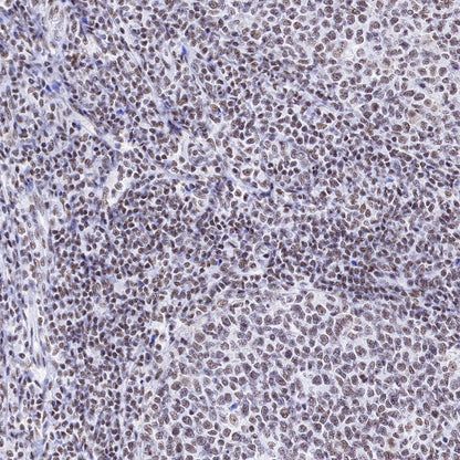 PIAS1 Recombinant Rabbit mAb (S-1430-7)
