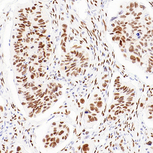 FOXP4 Recombinant Rabbit mAb (S-6198)