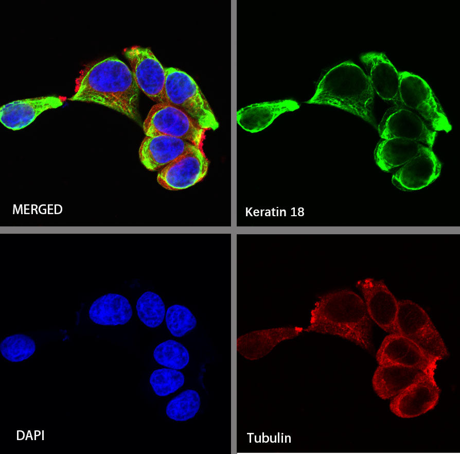 S-RMab® Keratin 18 Recombinant Rabbit mAb (SDT-012-7)