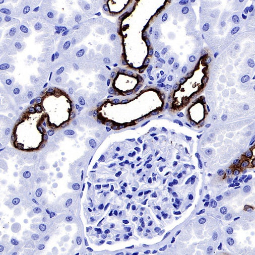 S-RMab® MUC1/EMA Recombinant Rabbit mAb (SDT-776-49)