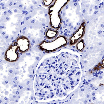 S-RMab® MUC1/EMA Recombinant Rabbit mAb (SDT-776-49)