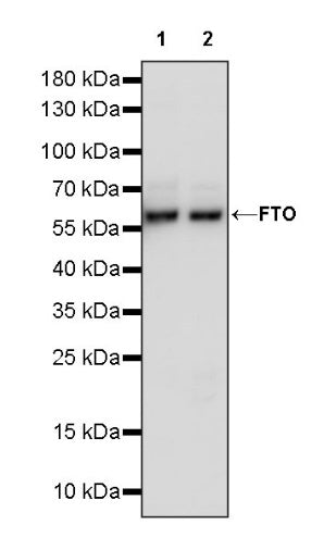 FTO Recombinant Rabbit mAb (S-1663-48)