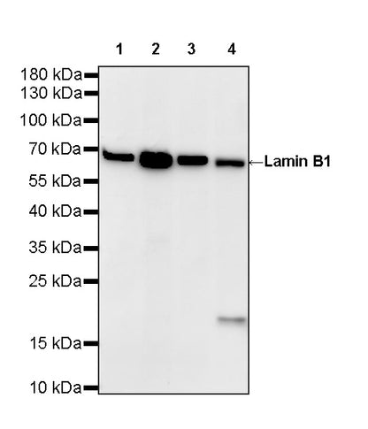 Lamin B1 Recombinant Rabbit mAb (S-5361)