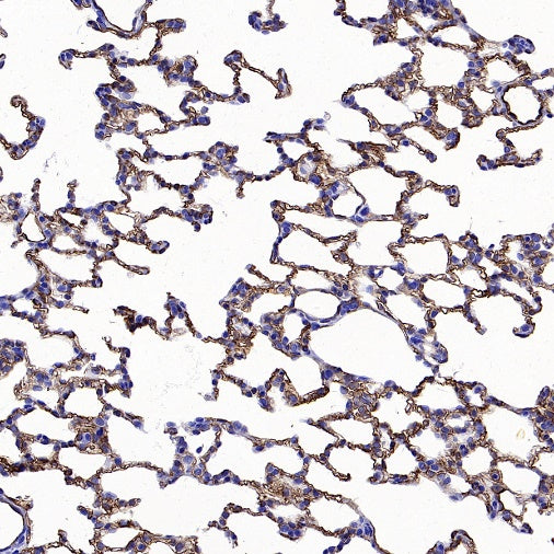 Angiotensin Converting Enzyme 1 Recombinant Rabbit mAb (SDT-2662-122)