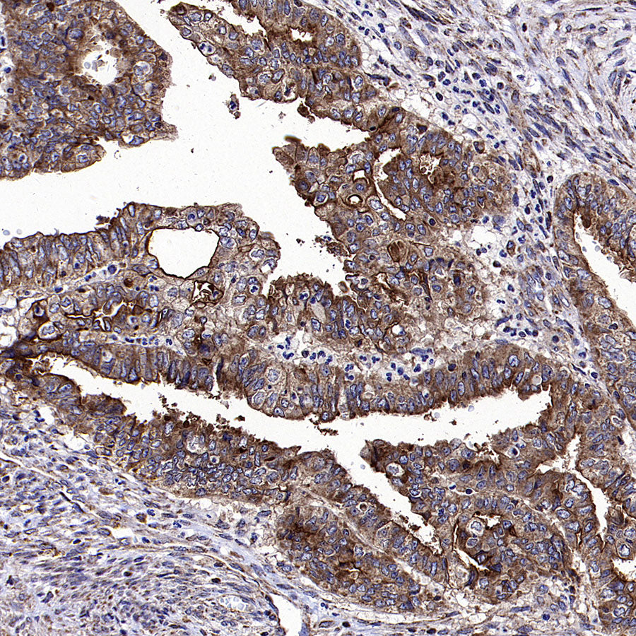 ADAM9 Recombinant Rabbit mAb (S-3270-74)