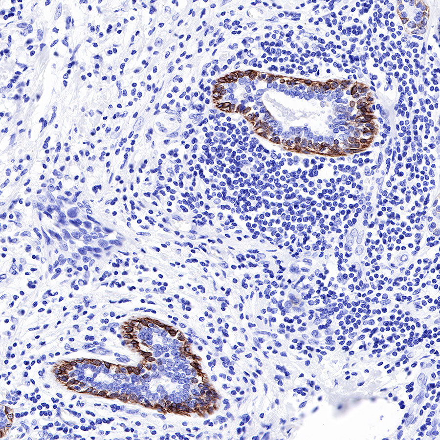 Keratin 17 Recombinant Rabbit mAb (SDT-011-43)