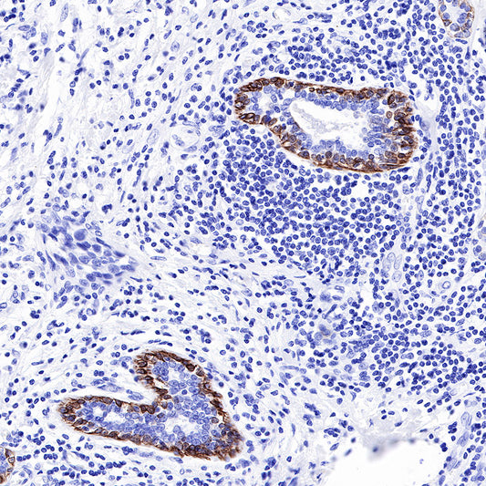 Keratin 17 Recombinant Rabbit mAb (SDT-011-43)