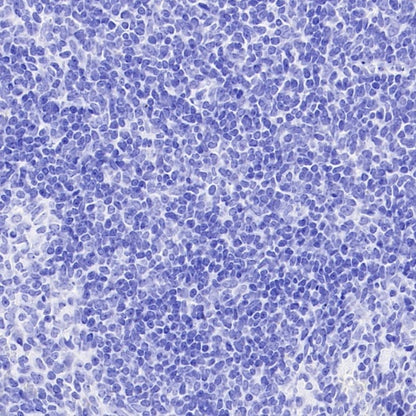 ETD Recombinant Rabbit mAb (S-3661-43)