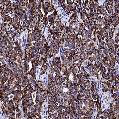 Mitofilin Recombinant Rabbit mAb (S-2277-37)