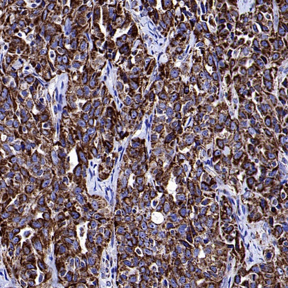 Mitofilin Recombinant Rabbit mAb (S-2277-37)