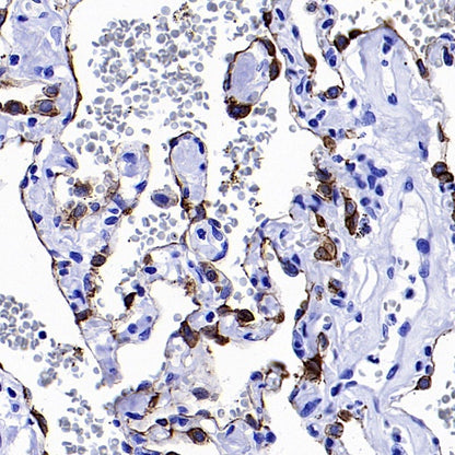 AQP4 Recombinant Rabbit mAb (S-1609-62)