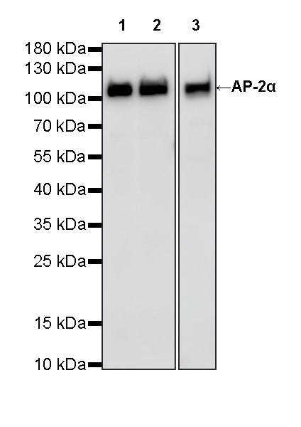 AP-2α Recombinant Rabbit mAb (S-4444-44)