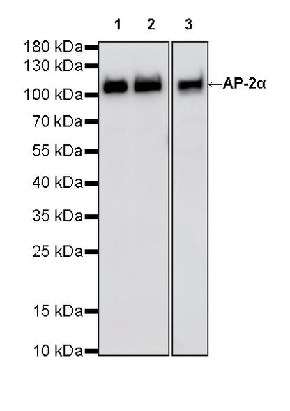AP-2α Recombinant Rabbit mAb (S-4444-44)