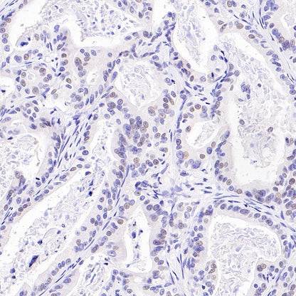 Histone H3 (acetyl K4) Recombinant Rabbit mAb (S-848-137)