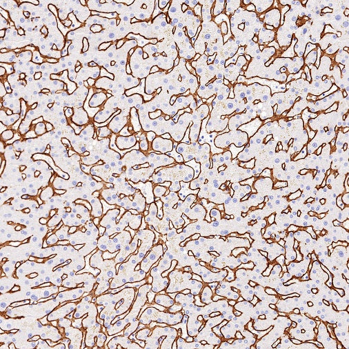 Collagen VI (COL6A1) Recombinant Rabbit mAb (S-1495-18)