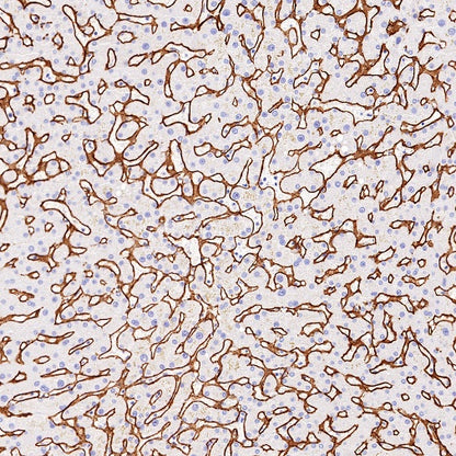 Collagen VI (COL6A1) Recombinant Rabbit mAb (S-1495-18)