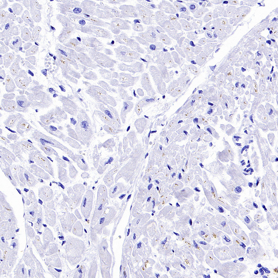PTK7 Recombinant Rabbit mAb ,PBS Only(SDT-2432-136)