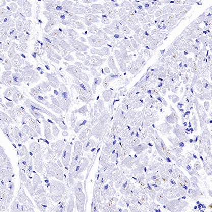 PTK7 Recombinant Rabbit mAb ,PBS Only(SDT-2432-136)
