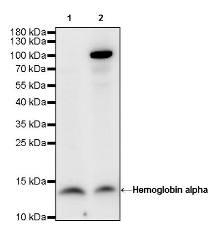 Hemoglobin alpha Recombinant Rabbit mAb (S-R242)