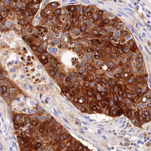 GPNMB Recombinant Rabbit mAb (S-491-6)