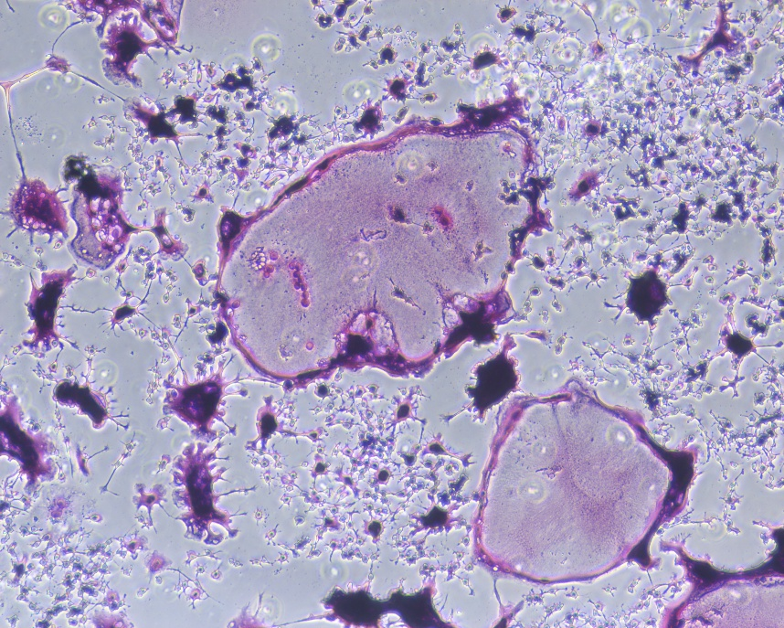 TRANCE/RANK L/TNFSF11 Protein, Mouse