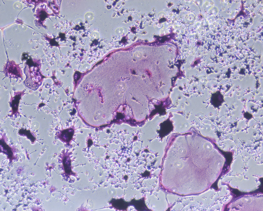 TRANCE/RANK L/TNFSF11 Protein, Mouse