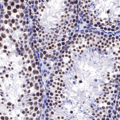 PARP1 Recombinant Rabbit mAb (S-220-179)