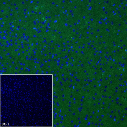p35/25 Recombinant Rabbit mAb (S-2719-47)