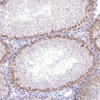 DAZL Recombinant Rabbit mAb (S-3113-35)