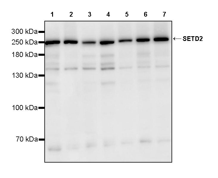 SETD2 Recombinant Rabbit mAb (S-3469-102)