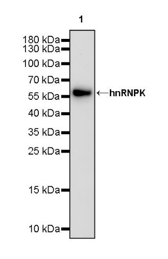 hnRNPK Recombinant Rabbit mAb (S-1645-45)