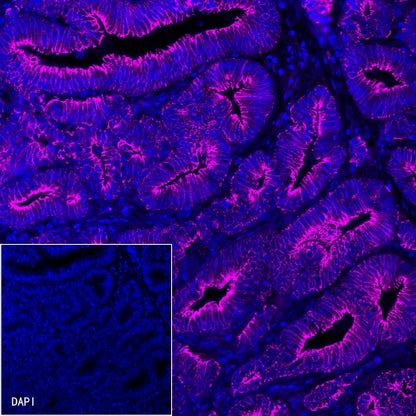 E-Cadherin Recombinant Rabbit mAb (Cy5 Conjugate) (S-438-5)