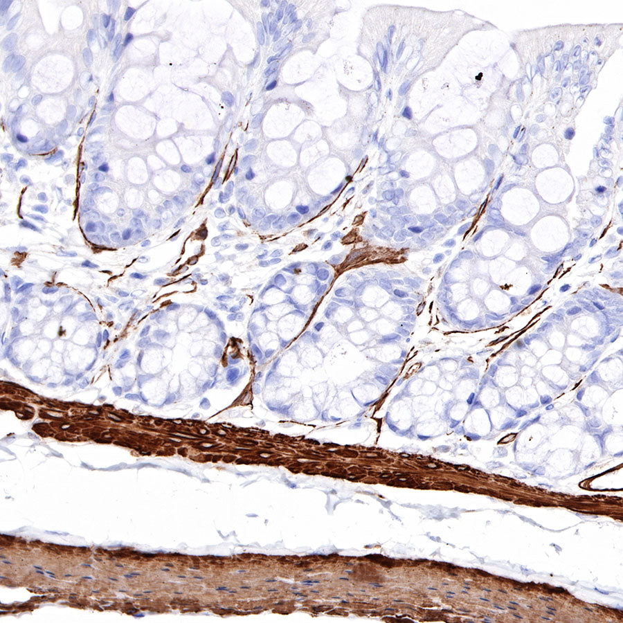 S-RMab® alpha smooth muscle Actin (SMA) Recombinant Rabbit mAb,PBS Only (SDT-301-142)