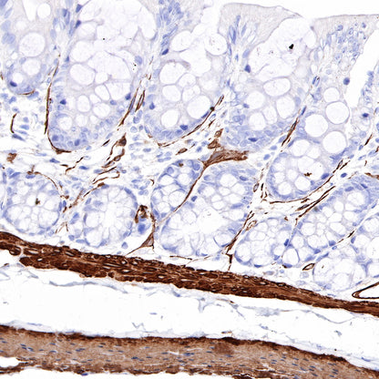 S-RMab® alpha smooth muscle Actin (SMA) Recombinant Rabbit mAb,PBS Only (SDT-301-142)