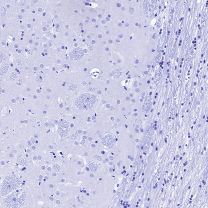 PNPLA2 Recombinant Rabbit mAb (S-5409)
