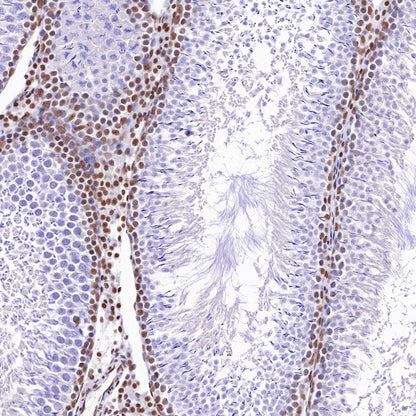 S-RMab® ATRX Recombinant Rabbit mAb (SDT-458-37)