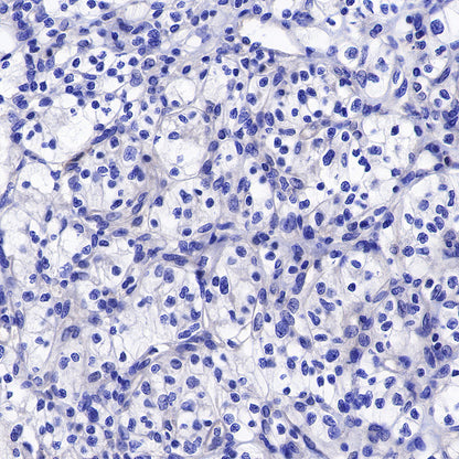 Galectin-3 Recombinant Rabbit mAb (SDT-370-111)