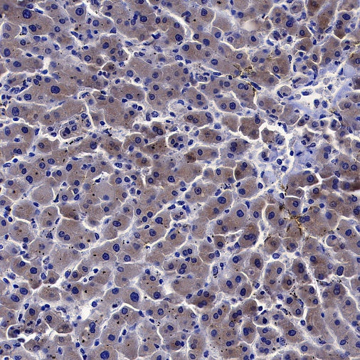Coagulation factor V Recombinant Rabbit mAb (S-4489-58)