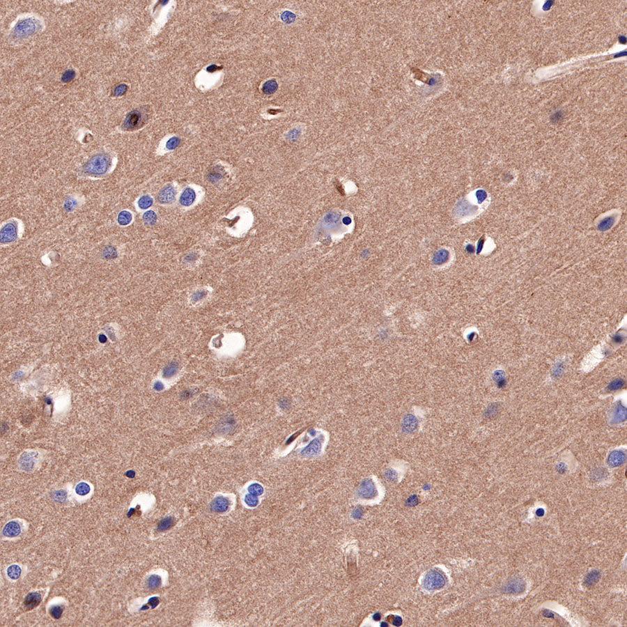 CD155/PVR Recombinant Rabbit mAb (SDT-289-68)