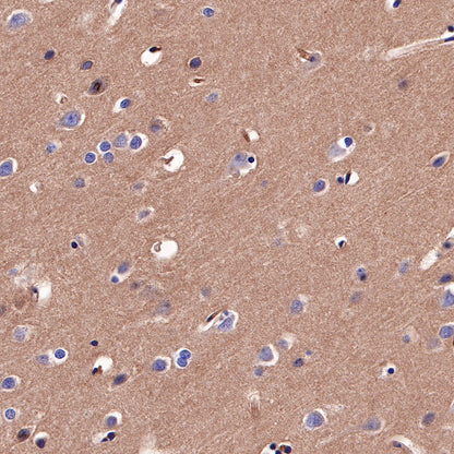 CD155/PVR Recombinant Rabbit mAb (SDT-289-68)