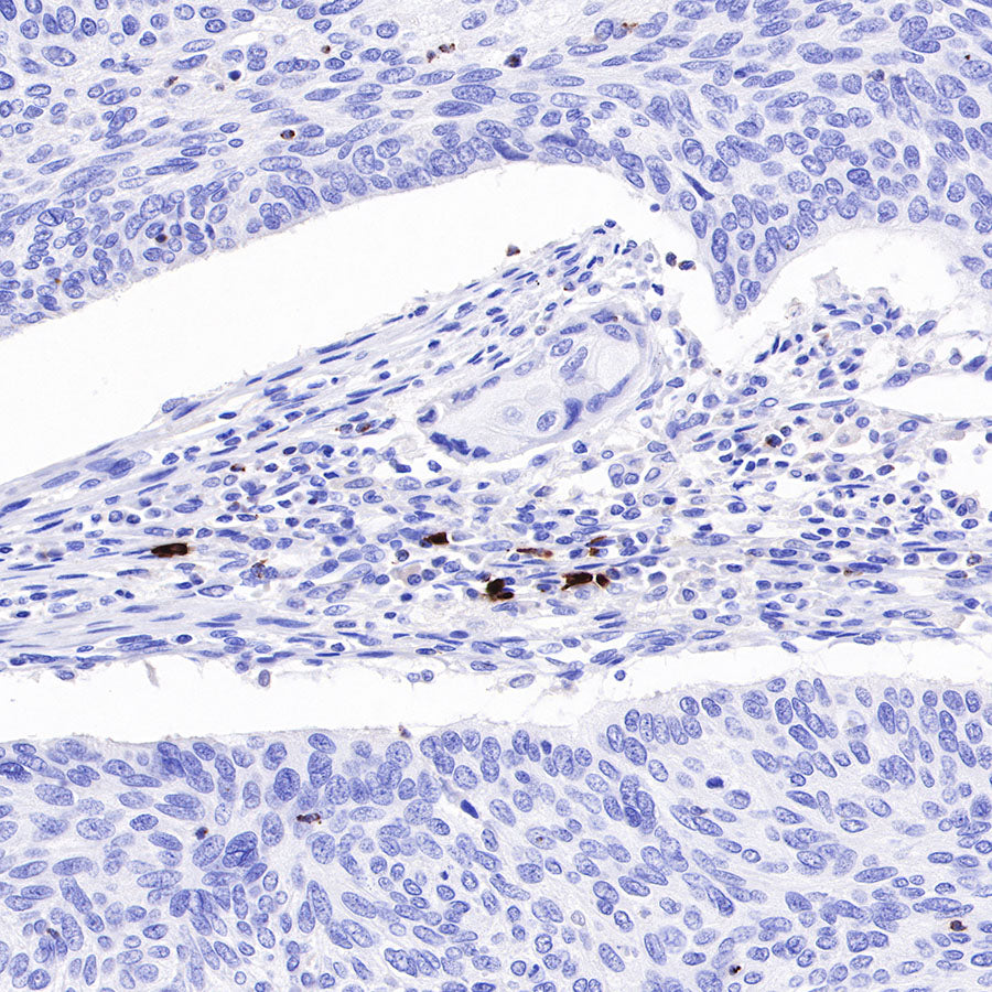 LAG3 Recombinant Rabbit mAb (SDT-R159)