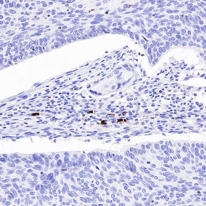 LAG3 Recombinant Rabbit mAb (SDT-R159)