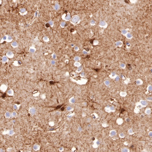 Glutamine Synthetase (GS) Recombinant Rabbit mAb (SDT-549-25)