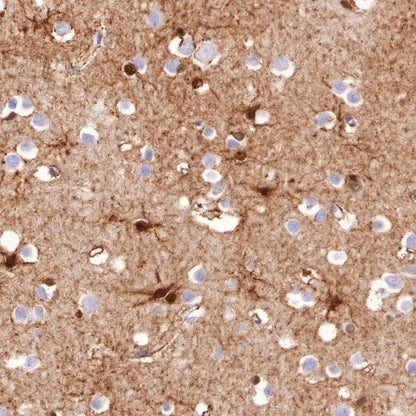 Glutamine Synthetase (GS) Recombinant Rabbit mAb (SDT-549-25)