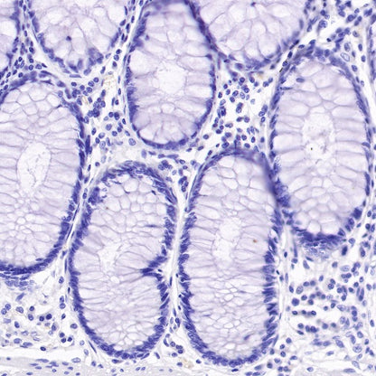 SAGE1 Recombinant Rabbit mAb (SDT-317-60)