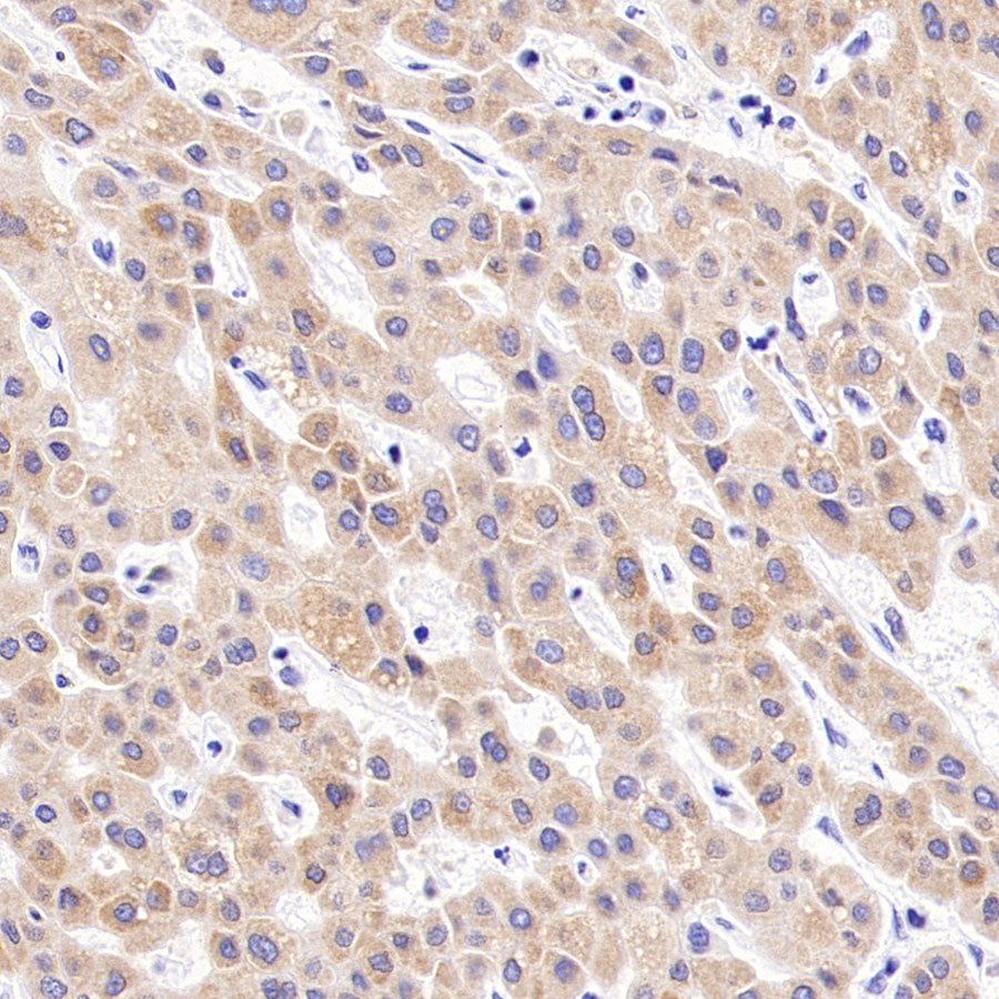 CDS1 Recombinant Rabbit mAb (S-3671-30)