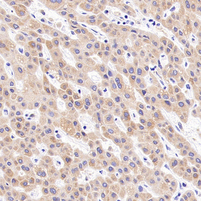 CDS1 Recombinant Rabbit mAb (S-3671-30)