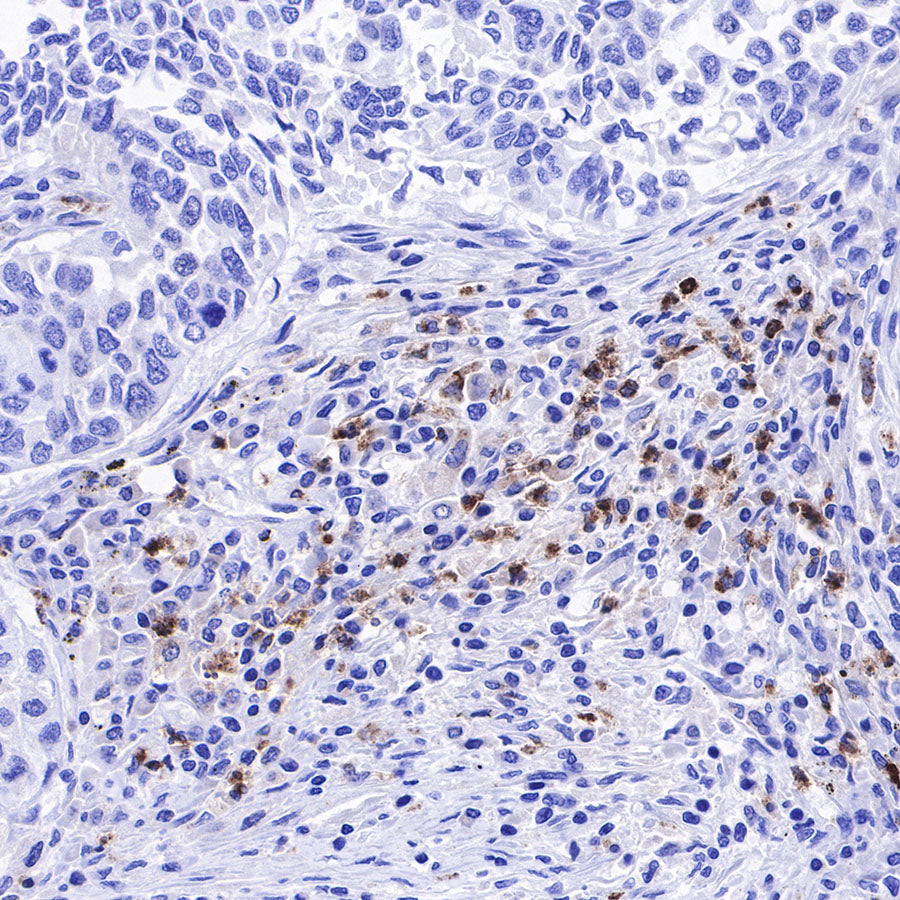 Lysozyme Recombinant Rabbit mAb (SDT-R176)